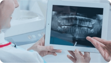 Hong Kong Wisdom Tooth Extraction Guide