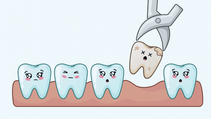 Shenzhen Tooth Extraction Introduction